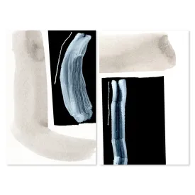 Adjacent, Set Of 2, By Dan Hobday